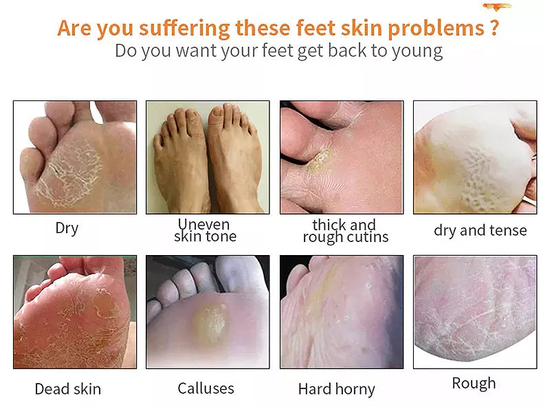 Fot Peeling Spray 110ml
