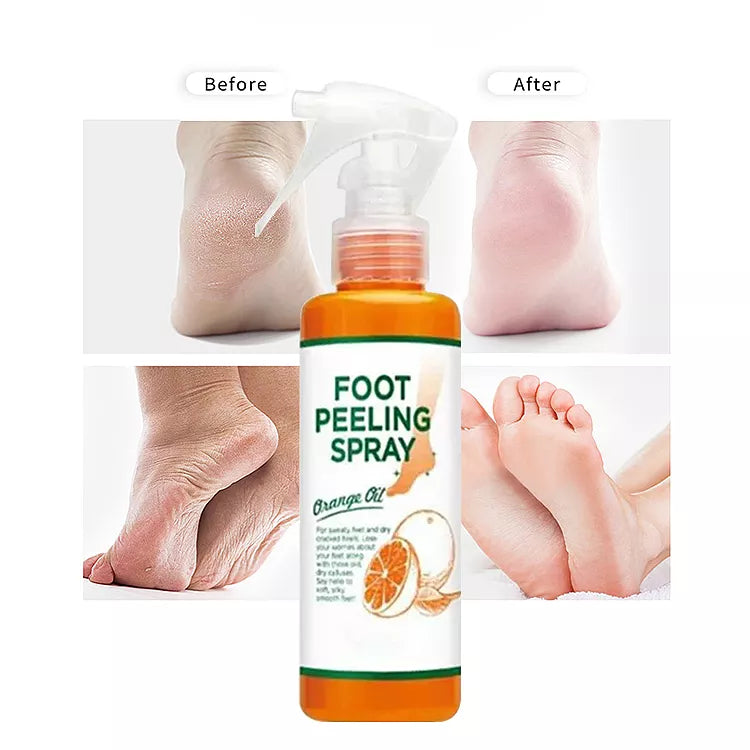 Fot Peeling Spray 110ml
